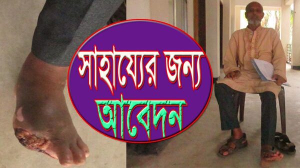 অসহায় আবুল বাসার মিয়াকে বাঁচাতে এগিয়ে আসুন