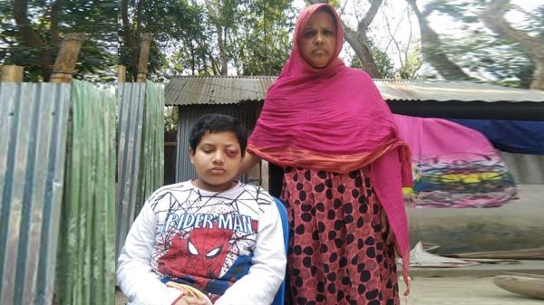 টাকার অভাবে চিকিৎসা বন্ধ শিশু জাভেদের