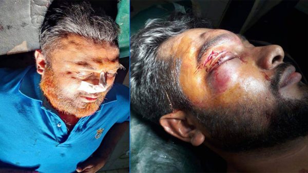 ফরিদপুরে নৌকা প্রতিকের প্রার্থীর উপর হামলা