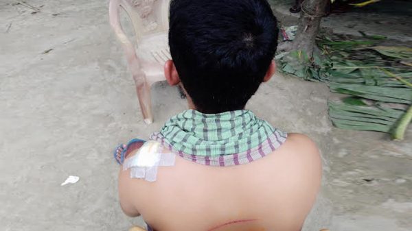 বোয়ালমারীতে ব্যবসায়ীকে কুপিয়ে টাকা ছিনতাই