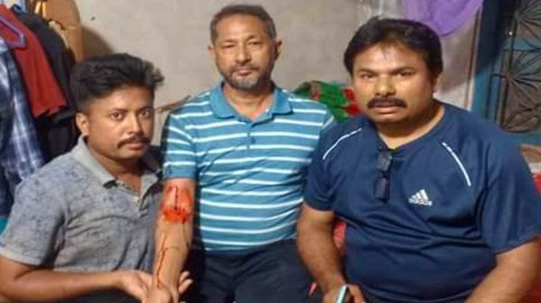 গুলিতে আহত ফরিদপুর জেলা বিএনপির সদস্য সচিব কিবরিয়া স্বপন