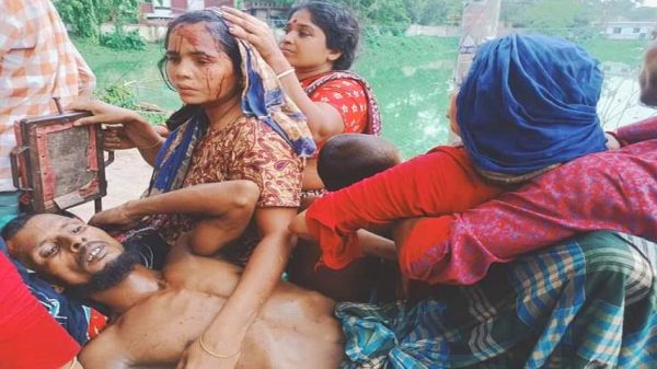 বোয়ালমারীতে এক পরিবারের তিন সদস্যকে কুপিয়ে আহত